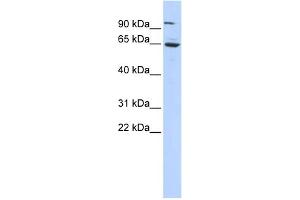 WB Suggested Anti-FOXJ3 Antibody Titration:  0. (FOXJ3 anticorps  (Middle Region))