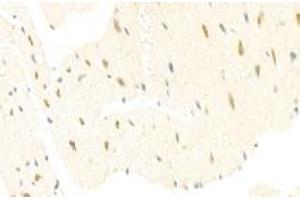 Immunohistochemistry analysis of paraffin-embedded mouse heart using mSin3A (ABIN7075609) at dilution of 1: 100