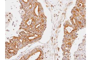 IHC-P Image Immunohistochemical analysis of paraffin-embedded human endo mitrial, using CCNDBP1, antibody at 1:100 dilution. (CCNDBP1 anticorps  (C-Term))