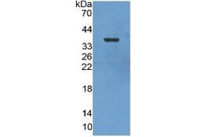 WB of Protein Standard: different control antibodies  against Highly purified E. (ENO2/NSE Kit ELISA)