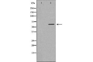 Western blot analysis of extracts from HeLa cells, using TBC1D3 antibody. (TBC1D3 anticorps)