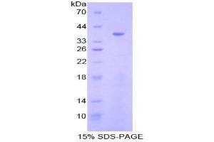 SDS-PAGE analysis of Human Cytovillin Protein.