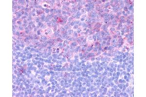 Anti-CCR3 antibody IHC of human tonsil.