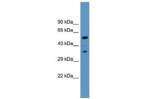 Western Blot showing MARCKS antibody used at a concentration of 1.