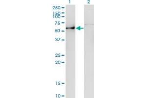Western Blot analysis of ANGPTL3 expression in transfected 293T cell line by ANGPTL3 monoclonal antibody (M01), clone 3B7.