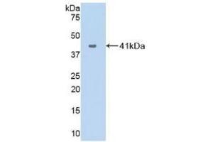 Detection of Recombinant VCC1, Human using Polyclonal Antibody to VEGF Co Regulated Chemokine 1 (VCC1) (CXCL17 anticorps  (AA 24-119))