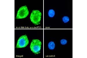(ABIN185267) Immunofluorescence analysis of paraformaldehyde fixed HepG2 cells, permeabilized with 0.