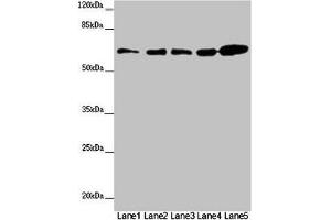 Western blot All lanes: ZBTB46 antibody at 2 μg/mL Lane 1: Mouse heart tissue Lane 2: Mouse liver tissue Lane 3: Mouse kidney tissue Lane 4: 293T whole cell lysate Lane 5: SH-SY5Y whole cell lysate Secondary Goat polyclonal to rabbit IgG at 1/10000 dilution Predicted band size: 65 kDa Observed band size: 65 kDa (ZBTB46 anticorps  (AA 174-362))