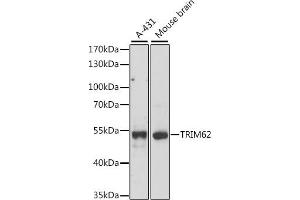 Western blot analysis of extracts of various cell lines, using TRIM62 antibody (ABIN7270996) at 1:1000 dilution.