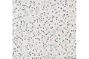 IHC analysis of SFPQ using anti-SFPQ antibody (ABIN7603089). (SFPQ anticorps  (Middle Region))