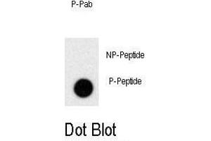 Dot blot analysis of anti-Phospho-PRL-p Antibody (ABIN389956 and ABIN2839758) on nitrocellulose membrane. (Prolactin anticorps  (pSer163))