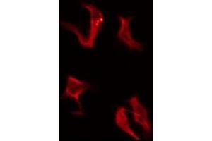 ABIN6276146 staining COLO205 by IF/ICC. (OR4A16 anticorps  (C-Term))