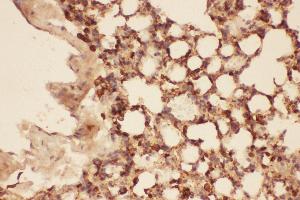 Anti-Cofilin Picoband antibody,  IHC(P): Mouse Lung Tissue