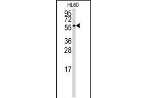 Western blot analysis of anti-CYP4Z1 Antibody in HL60 cell line lysates (35ug/lane). (CYP4Z1 anticorps  (N-Term))