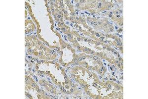 Immunohistochemistry of paraffin-embedded human kidney using PPID Antibody.