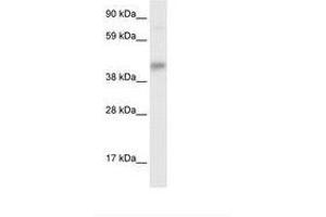Image no. 1 for anti-SEC14-Like 2 (SEC14L2) (AA 245-294) antibody (ABIN6735907) (SEC14L2 anticorps  (AA 245-294))