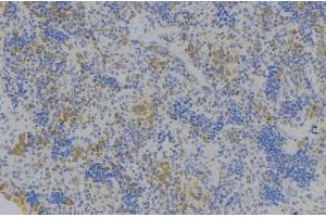 ABIN6278119 at 1/100 staining Human lymph node tissue by IHC-P. (GPA33 anticorps  (Internal Region))
