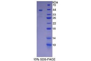 SDS-PAGE analysis of Rat Mucin 5B Protein.
