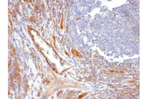 Formalin-fixed, paraffin-embedded human Tonsil stained with CD31 Mouse Monoclonal Antibody (C31. (CD31 anticorps)