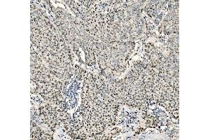 IHC analysis of JUNB using anti-JUNB antibody (ABIN7603223). (JunB anticorps  (N-Term))