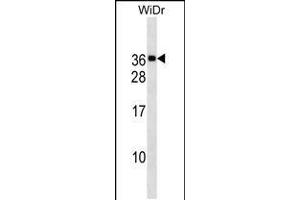 Western blot analysis in WiDr cell line lysates (35ug/lane). (MED30 anticorps  (AA 107-133))