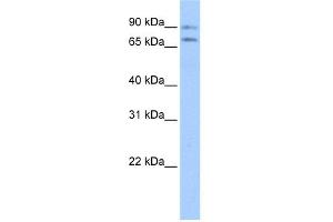 WB Suggested Anti-JPH2 Antibody Titration:  0. (Junctophilin 2 anticorps  (Middle Region))