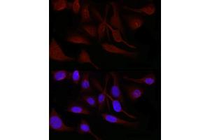 Immunofluorescence analysis of U2OS cells using SNRPD1 Rabbit pAb (ABIN7270363) at dilution of 1:50 (40x lens). (SNRPD1 anticorps  (AA 1-100))