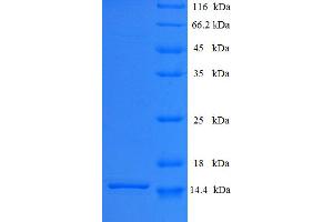 SDS-PAGE (SDS) image for Surfactant Associated 3 (SFTA3) (AA 1-94), (full length) protein (His tag) (ABIN5710358) (SFTA3 Protein (AA 1-94, full length) (His tag))