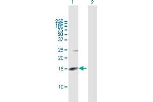 Western Blot analysis of RHBDL2 expression in transfected 293T cell line by RHBDL2 MaxPab polyclonal antibody. (RHBDL2 anticorps  (AA 1-121))