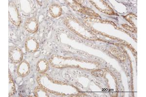 Immunoperoxidase of monoclonal antibody to CTSK on formalin-fixed paraffin-embedded human kidney. (Cathepsin K anticorps  (AA 220-329))