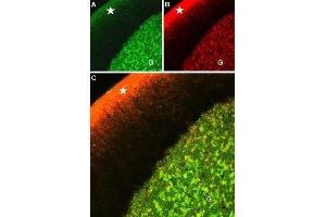 Multiplex staining of CaV1.