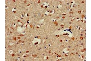 Immunohistochemistry of paraffin-embedded human brain tissue using ABIN7143961 at dilution of 1:100