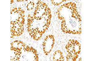 IHC staining of normal colon with p53 antibody (DO-7). (p53 anticorps  (AA 20-25))