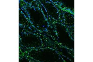 IF analysis of Claudin18/CLDN18 using anti-Claudin18/CLDN18 antibody (ABIN7601257). (Claudin 18 anticorps  (AA 31-261))