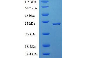 SDS-PAGE (SDS) image for Signal Recognition Particle 19kDa (SRP19) (AA 2-144) protein (His-SUMO Tag) (ABIN5710416)