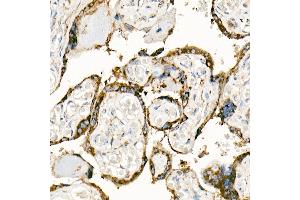 Immunohistochemistry of paraffin-embedded Human placenta using FasLG antibody (ABIN3020741, ABIN3020742, ABIN3020743, ABIN1512897 and ABIN6213701) at dilution of 1:150 (40x lens).