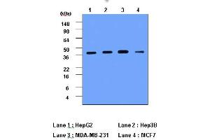 Western Blotting (WB) image for anti-Cathepsin D (CTSD) (AA 21-412) antibody (ABIN317502) (Cathepsin D anticorps  (AA 21-412))