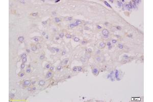 Formalin-fixed and paraffin embedded human placenta tissue labeled with Anti-Frizzled 7/FZE3 Polyclonal Antibody, Unconjugated (ABIN710051) at 1:200, followed by conjugation to the secondary antibody and DAB staining