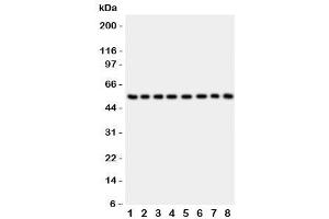 Western blot testing of P2X2 antibody and Lane 1:  rat brain (P2RX2 anticorps  (AA 139-471))