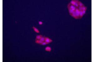 Immunofluorecence staining of GPC3 polyclonal antibody  on HepG2 cells . (Glypican 3 anticorps  (AA 530-560))
