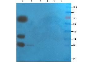 Western Blot using anti-SNAP25 antibody ABIN7072250 Mouse brain (lane 1), mouse rectum (lane 2), mouse pancreas (lane 3), human lung cancer (lane 4), human breast cancer (lane 5) and Hela cell(lane 6) samples were resolved on a 12 % SDS PAGE gel and blots probed with ABIN7072250 at 2 μg/mL before being detected by a secondary antibody.