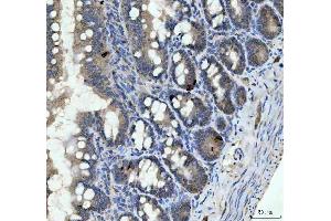 IHC analysis of Chromogranin A/Chga using anti-Chromogranin A/Chga antibody (ABIN7601533).