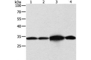 Western Blot analysis of Hela and Jurkat cell, Mouse brain tissue and 293T cell using NAPA Polyclonal Antibody at dilution of 1:500 (NAPA anticorps)