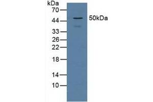 Figure. (Proteasome 26S Subunit, Non ATPase 5 (AA 143-341) anticorps)