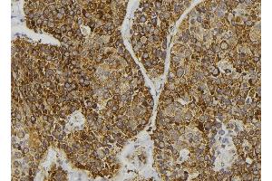ABIN6276625 at 1/100 staining Human pancreas tissue by IHC-P. (GIPC2 anticorps  (C-Term))