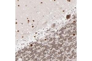 Immunohistochemical staining of human cerebellum with RP13-102H201 polyclonal antibody  shows nuclear positivity in purkinje cells, cells in molecular layer and cells in granular layer at 1:10-1:20 dilution.