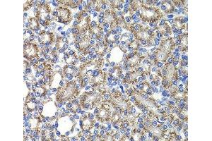Immunohistochemistry of paraffin-embedded Rat kidney using COPS2 Polyclonal Antibody at dilution of 1:100 (40x lens).