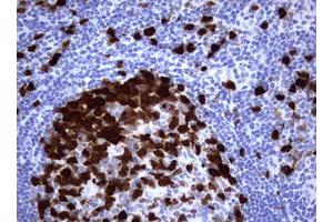 Image no. 1 for anti-Thymidylate Synthetase (TYMS) antibody (ABIN1501595)