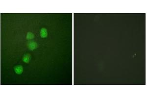 Immunofluorescence analysis of HuvEc cells, using Cyclin E1 (epitope around residue 395) antibody (ABIN5976158). (Cyclin E1 anticorps  (Thr395))