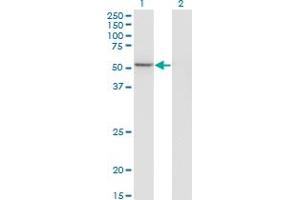 Western Blot analysis of GABPA expression in transfected 293T cell line by GABPA monoclonal antibody (M03), clone M1.